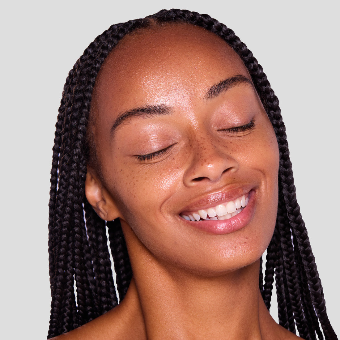 Freckles by AurialLift™