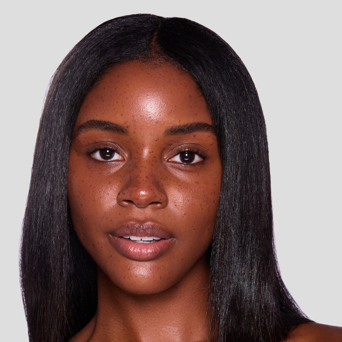 Freckles by AurialLift™